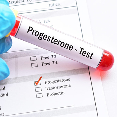 تصویری از یک لوله آزمایشگاهی که روی آن نوشته شده progestrone test